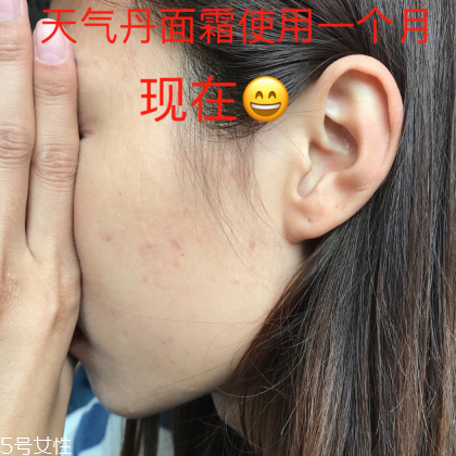 whoo后的天氣丹效果怎么樣 敏感肌也可以放心使用 whoo后的天氣丹效果怎么樣 敏感肌也可以放心使用