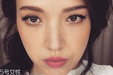 雀斑是什么原因引起的 遺傳性祛斑很難去除 雀斑是什么原因引起的 遺傳性祛斑很難去除