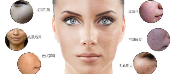 光子嫩膚多少錢 這個(gè)價(jià)格并不貴 光子嫩膚多少錢 這個(gè)價(jià)格并不貴