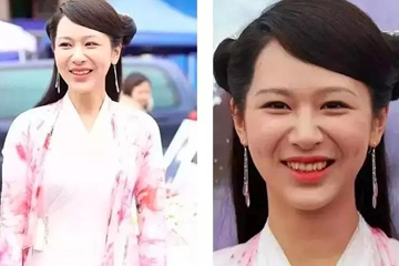 法令紋明顯什么原因 6個原因讓你少年老成 法令紋明顯什么原因 6個原因讓你少年老成