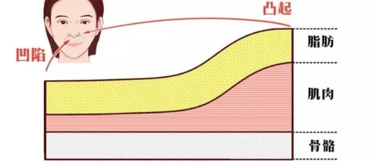 法令紋明顯什么原因 6個原因讓你少年老成 法令紋明顯什么原因 6個原因讓你少年老成