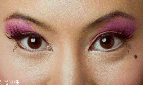 點(diǎn)痣是掛什么科 這個(gè)科室才對(duì) 點(diǎn)痣是掛什么科 這個(gè)科室才對(duì)