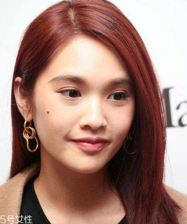 點(diǎn)痣是永久的嗎 點(diǎn)痣后一般不會(huì)再長