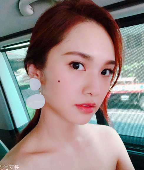 點(diǎn)痣能吃芒果嗎 芒果是發(fā)物不建議吃 點(diǎn)痣能吃芒果嗎 芒果是發(fā)物不建議吃