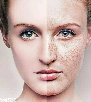 皮秒會(huì)反黑嗎 這是正常現(xiàn)象