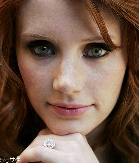 皮秒能去老年斑嗎 這個是必須的 皮秒能去老年斑嗎 這個是必須的