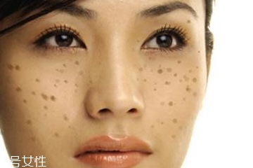 皮秒對皮膚有傷害嗎 安全不傷皮膚 皮秒對皮膚有傷害嗎 安全不傷皮膚