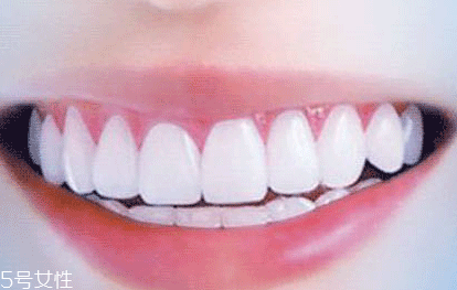 牙膏潔凈劑有哪些 2種成分會(huì)加重口腔潰瘍