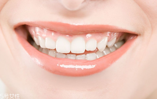 含氟牙膏能預(yù)防齲齒嗎 氟化物能對(duì)抗齲齒 含氟牙膏能預(yù)防齲齒嗎 氟化物能對(duì)抗齲齒