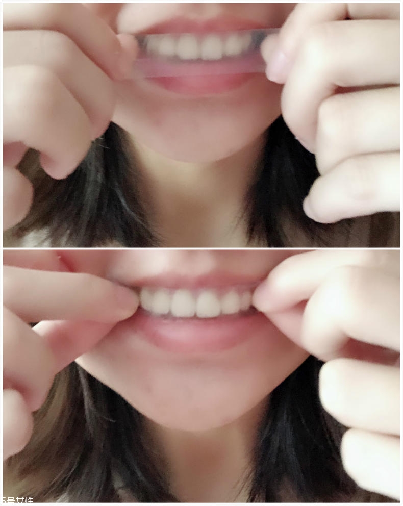 佳潔士美白牙貼有害嗎 不會(huì)傷害到牙釉質(zhì) 佳潔士美白牙貼有害嗎 不會(huì)傷害到牙釉質(zhì)