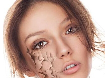 皮膚缺水的原因 改善皮膚干燥的補(bǔ)水小方法 皮膚缺水的原因 改善皮膚干燥的補(bǔ)水小方法