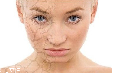 皮膚干燥起皮怎么辦？該如何保養(yǎng)