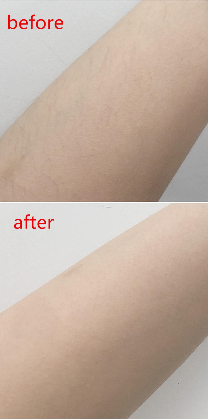 飛利浦脫毛儀怎么用 手把手教你怎么脫毛 飛利浦脫毛儀怎么用 手把手教你怎么脫毛