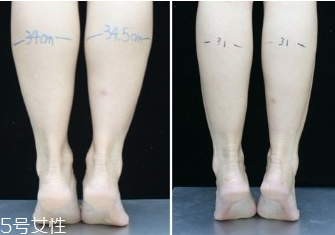 一周瘦腿的最快方法 一周瘦腿瘦成筷子腿 一周瘦腿的最快方法 一周瘦腿瘦成筷子腿