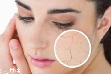 夏天吹空調(diào)皮膚會(huì)干嗎 做到這幾點(diǎn)就好 夏天吹空調(diào)皮膚會(huì)干嗎 做到這幾點(diǎn)就好