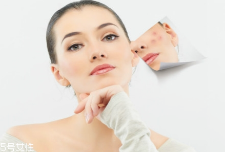 熬夜長痘痘怎么辦？去除痘痘小竅門