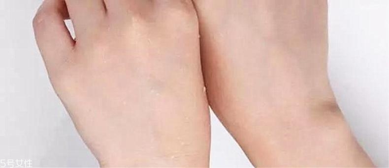 赫拉氣墊適合干皮嗎 大干皮簡(jiǎn)直不要太歡喜 赫拉氣墊適合干皮嗎 大干皮簡(jiǎn)直不要太歡喜