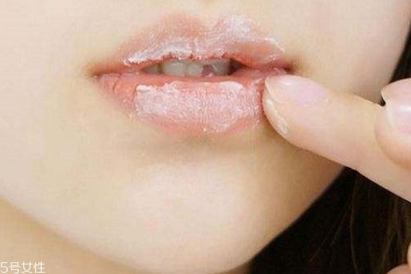 唇部去角質(zhì)的自制方法 這個(gè)妙招省錢(qián)又有效 唇部去角質(zhì)的自制方法 這個(gè)妙招省錢(qián)又有效