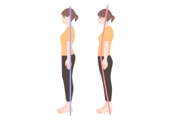 骨盆前傾怎么判斷 這個(gè)簡單方法看出假翹臀 骨盆前傾怎么判斷 這個(gè)簡單方法看出假翹臀