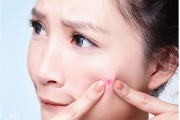 悶痘怎么才能發(fā)出來 長悶痘這樣快速消除 悶痘怎么才能發(fā)出來 長悶痘這樣快速消除