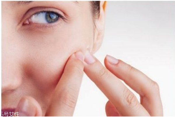 悶痘怎么才能發(fā)出來 長悶痘這樣快速消除 悶痘怎么才能發(fā)出來 長悶痘這樣快速消除