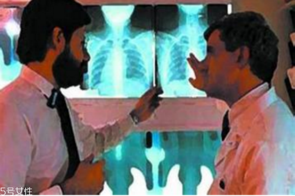 揪出早期肺癌 低劑量電腦斷層檢查 揪出早期肺癌 低劑量電腦斷層檢查