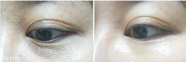 微針眼膜能天天使用嗎 一個禮拜用一次 微針眼膜能天天使用嗎 一個禮拜用一次