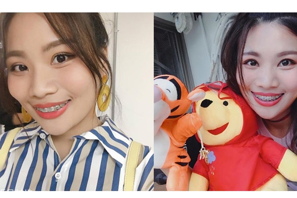 國字臉怎么瘦臉 4方法和方形臉說掰掰 國字臉怎么瘦臉 4方法和方形臉說掰掰