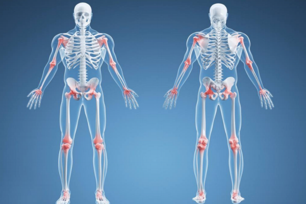 痛風(fēng)正確治療觀念 痛風(fēng)吃與不吃說明 痛風(fēng)正確治療觀念 痛風(fēng)吃與不吃說明