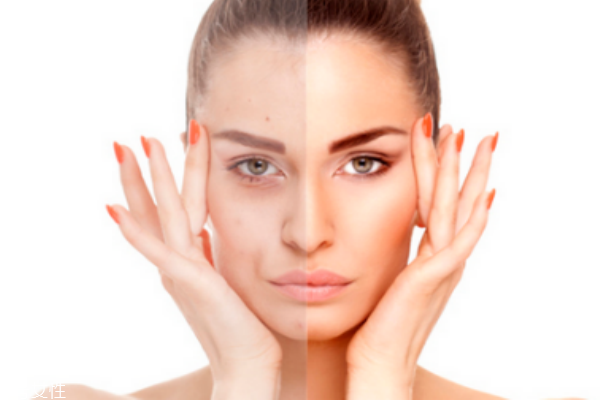 美白產(chǎn)品什么牌子好 十款美白產(chǎn)品讓你選 美白產(chǎn)品什么牌子好 十款美白產(chǎn)品讓你選