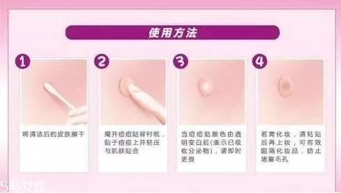 痘痘貼什么時候貼 剛擠完有傷口的時候 痘痘貼什么時候貼 剛擠完有傷口的時候