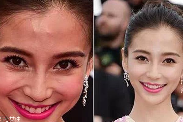 額頭大量冒痘什么原因 綠豆紅棗蓮藕能瀉火 額頭大量冒痘什么原因 綠豆紅棗蓮藕能瀉火