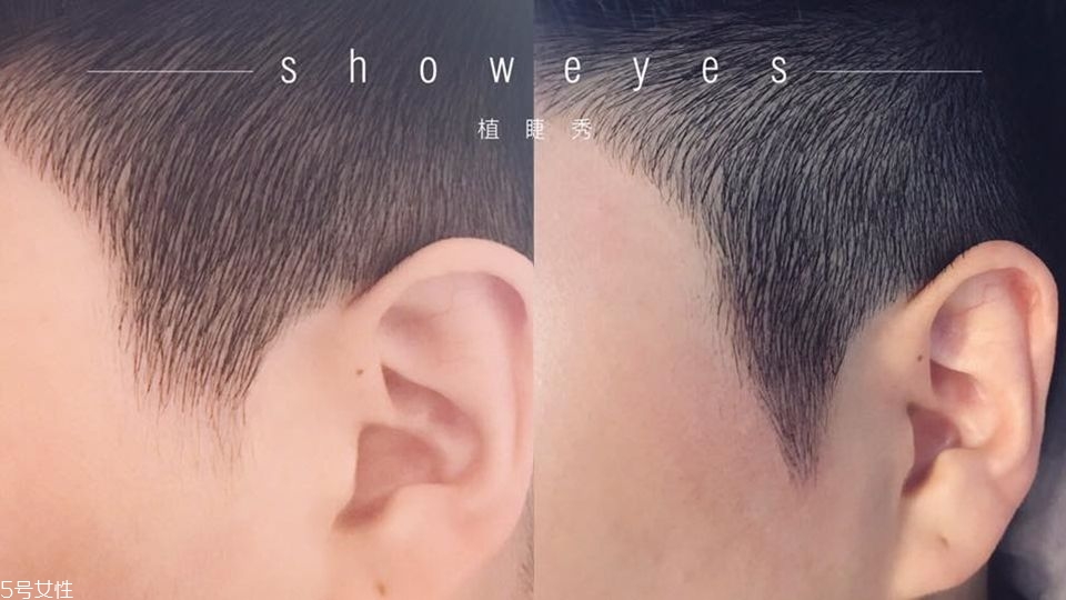 發(fā)量少怎么增加發(fā)量 禿發(fā)女孩必學發(fā)量激増6招