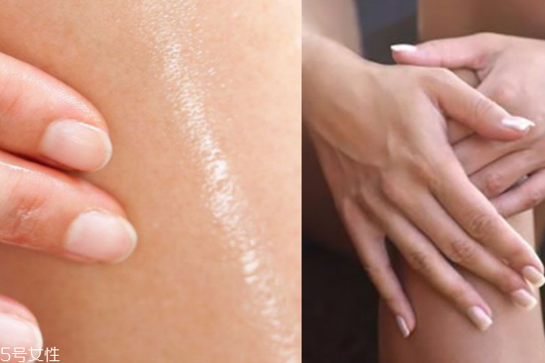 小腿干有魚鱗皮怎么辦 這3點(diǎn)你一定要知道 小腿干有魚鱗皮怎么辦 這3點(diǎn)你一定要知道