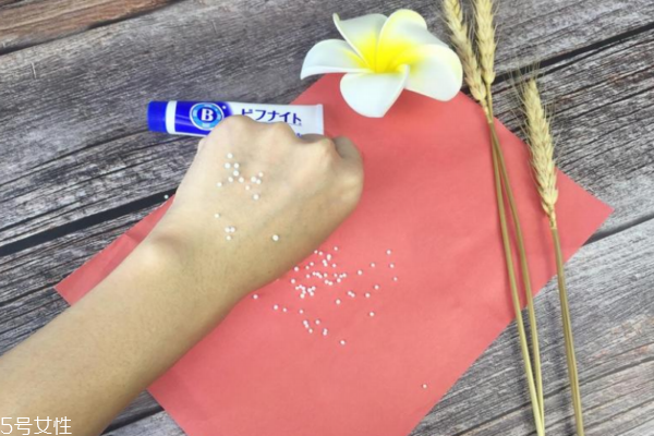 小林祛痘膏效果怎么樣 味道難聞卻是實(shí)力派 小林祛痘膏效果怎么樣 味道難聞卻是實(shí)力派