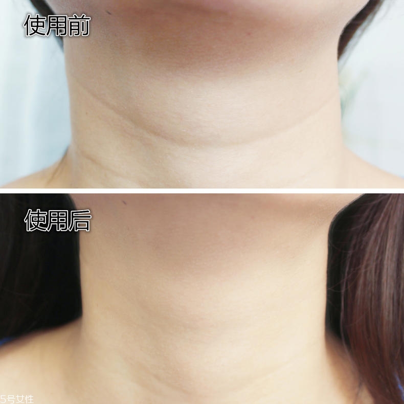 嬌韻詩(shī)頸霜每周用幾回 每天用才有效 嬌韻詩(shī)頸霜每周用幾回 每天用才有效