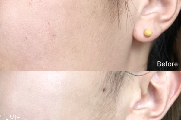 蘭蔻小黑瓶加fresh紅茶精華疊加使用 一加一大于二的效果 蘭蔻小黑瓶加fresh紅茶精華疊加使用 一加一大于二的效果