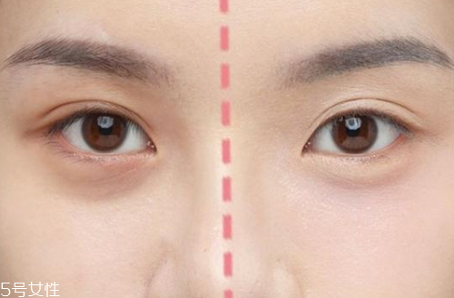 眼下遮瑕卡粉怎么辦 眼下的底妝別上太多 眼下遮瑕卡粉怎么辦 眼下的底妝別上太多