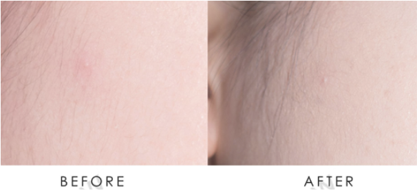 遮瑕膏怎么用比較自然 如何上出完美底妝 遮瑕膏怎么用比較自然 如何上出完美底妝