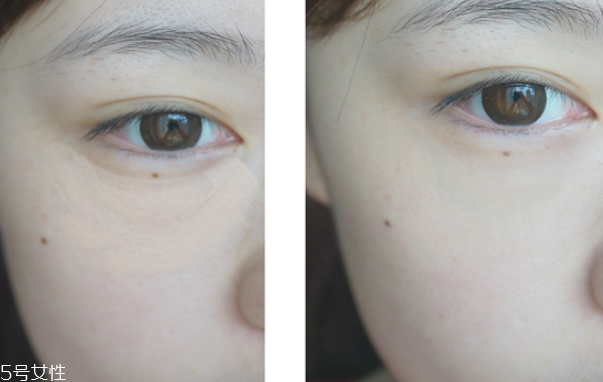 遮瑕筆和氣墊哪個先用 無暇底妝遮瑕一步搞定 遮瑕筆和氣墊哪個先用 無暇底妝遮瑕一步搞定