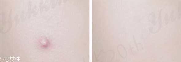 遮瑕筆和氣墊哪個先用 無暇底妝遮瑕一步搞定 遮瑕筆和氣墊哪個先用 無暇底妝遮瑕一步搞定