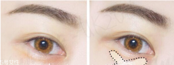 遮瑕筆和氣墊哪個先用 無暇底妝遮瑕一步搞定 遮瑕筆和氣墊哪個先用 無暇底妝遮瑕一步搞定