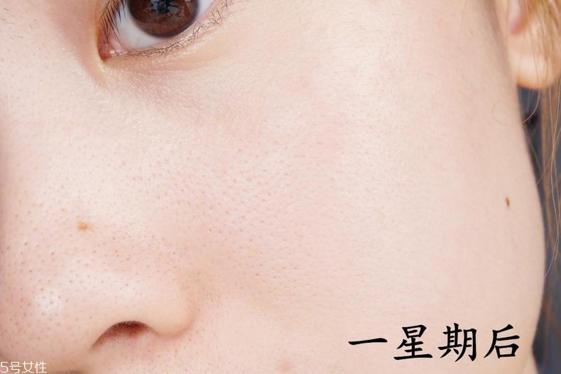 希思黎全能乳液效果如何 為換季脆弱肌保駕護(hù)航 希思黎全能乳液效果如何 為換季脆弱肌保駕護(hù)航