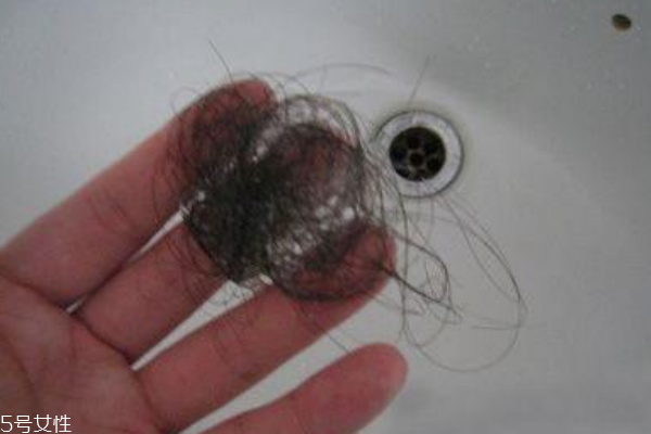 女性脫發(fā)多半與月經(jīng)失調(diào)有關(guān)系 女性脫發(fā)多半與月經(jīng)失調(diào)有關(guān)系