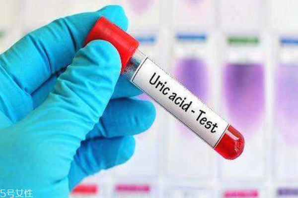 體檢尿酸偏高有痛風危險如何應(yīng)對 體檢尿酸偏高有痛風危險如何應(yīng)對