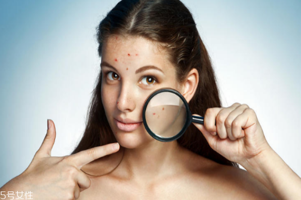 毛孔粗大用什么精華液 選對了逆齡美肌不是夢 毛孔粗大用什么精華液 選對了逆齡美肌不是夢