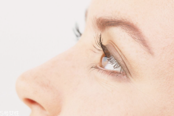 魚尾紋除皺針管用嗎 魚尾紋除皺針多久見效 魚尾紋除皺針管用嗎 魚尾紋除皺針多久見效