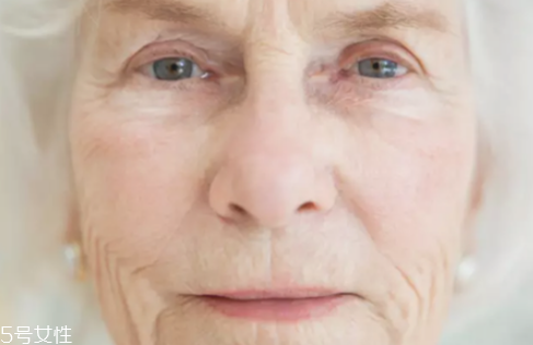 去眼部皺紋最好的方法 魚(yú)尾紋除皺方法 去眼部皺紋最好的方法 魚(yú)尾紋除皺方法