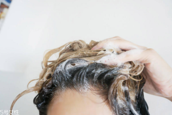 為什么洗完頭隔天還癢 4個(gè)方面要注意 為什么洗完頭隔天還癢 4個(gè)方面要注意