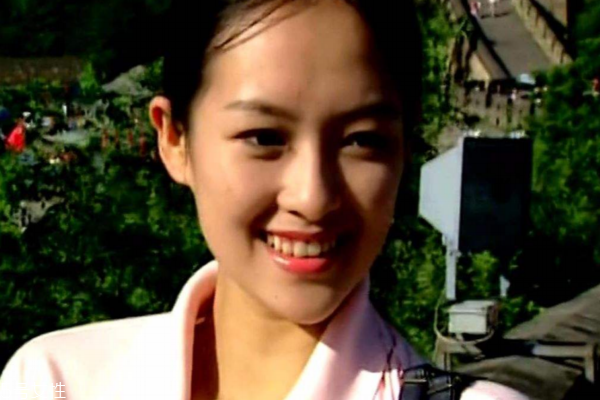 換季時(shí)激素臉怎么修復(fù) 這3點(diǎn)要做到 換季時(shí)激素臉怎么修復(fù) 這3點(diǎn)要做到